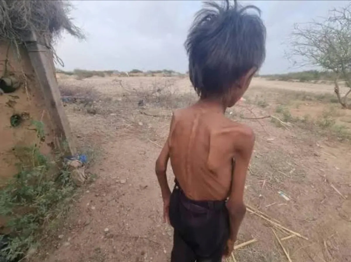 Yemen: Houthi Policies Fueling Widespread Hunger and Potential Uprising